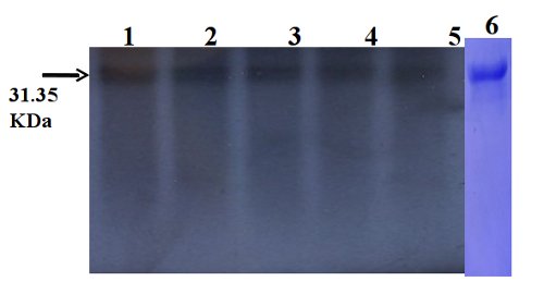 western blot using anti-AP2 antibodies